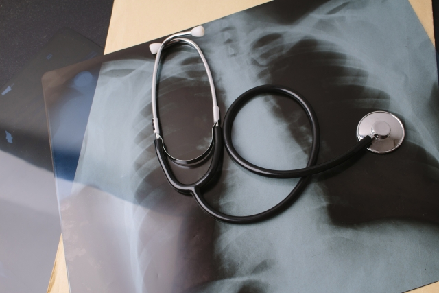 聴診器と胸部X線写真
